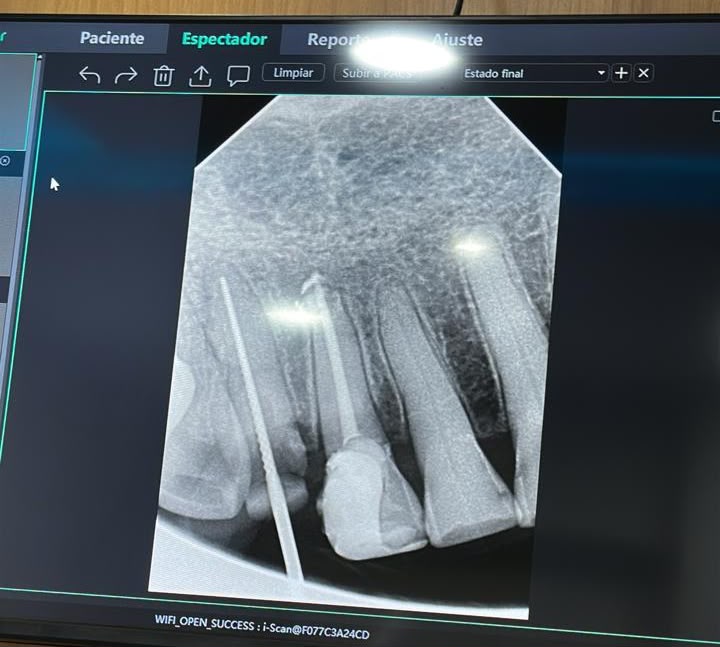 Consultorio real de Innovadent para tratamientos de endodoncia