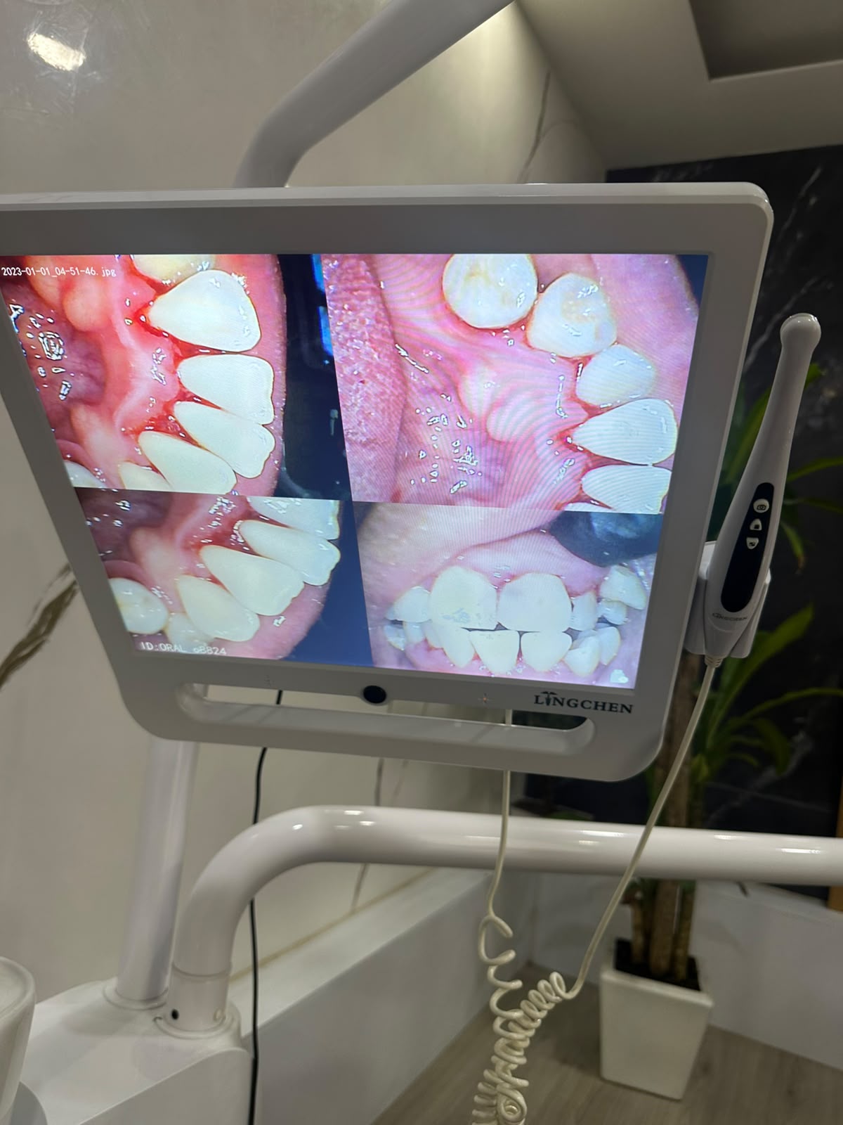 Consultorio real de Innovadent donde se realizan limpiezas dentales